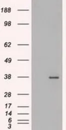 Anti-FGF2 antibody [3D9] used in Western Blot (WB). GTX84502