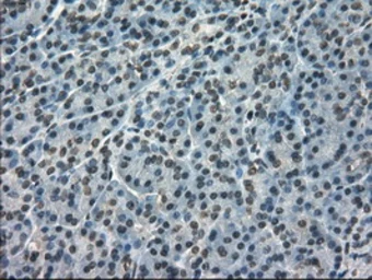 Anti-Mig-2 antibody [14A11] used in IHC (Paraffin sections) (IHC-P). GTX84506