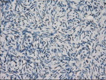 Anti-CD32a antibody [16D6] used in IHC (Paraffin sections) (IHC-P). GTX84509