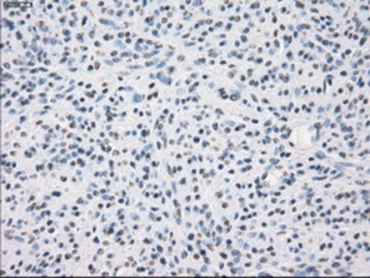 Anti-CD32a antibody [13G9] used in IHC (Paraffin sections) (IHC-P). GTX84513
