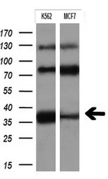 Anti-CD32a antibody [13G9] used in Western Blot (WB). GTX84513