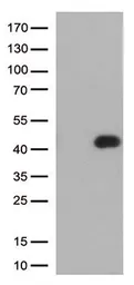 Anti-CD32a antibody [13G9] used in Western Blot (WB). GTX84513