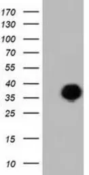 Anti-FAM84B antibody [4A4] used in Western Blot (WB). GTX84525