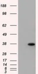 Anti-ERCC1 antibody [2A7] used in Western Blot (WB). GTX84550