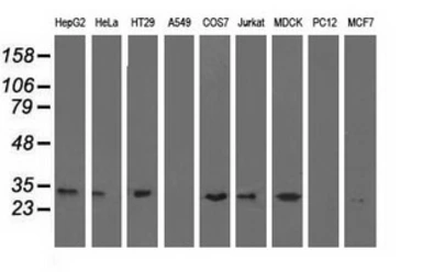 Anti-ERCC1 antibody [2A9] used in Western Blot (WB). GTX84555