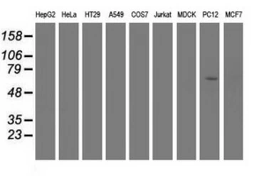 Anti-EPM2AIP1 antibody [5G8] used in Western Blot (WB). GTX84566