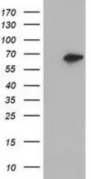 Anti-EPXH2 antibody [2F2] used in Western Blot (WB). GTX84567