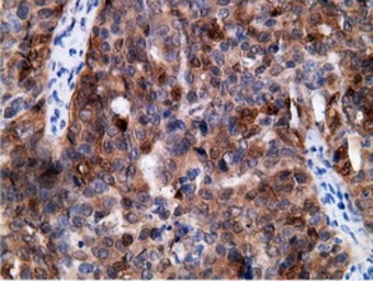 Anti-EPXH2 antibody [1H5] used in IHC (Paraffin sections) (IHC-P). GTX84569