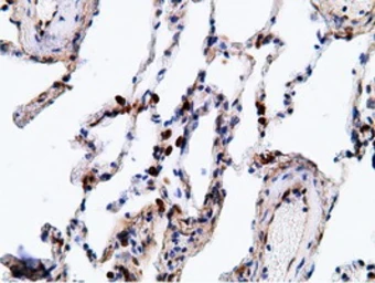 Anti-EPXH2 antibody [1H5] used in IHC (Paraffin sections) (IHC-P). GTX84569