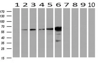 Anti-EPXH2 antibody [1H5] used in Western Blot (WB). GTX84569
