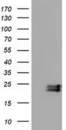 Anti-Ephrin A2 antibody [2B7] used in Western Blot (WB). GTX84588