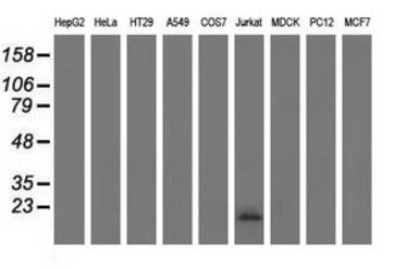 Anti-Ephrin A2 antibody [2B7] used in Western Blot (WB). GTX84588