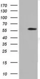 Anti-DYNC1LI1 antibody [2E8] used in Western Blot (WB). GTX84594