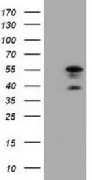 Anti-DYNC1LI1 antibody [1B9] used in Western Blot (WB). GTX84596