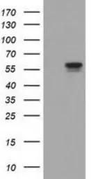 Anti-DYNC1LI1 antibody [1D1] used in Western Blot (WB). GTX84597
