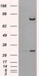 Anti-CD26 antibody [11D7] used in Western Blot (WB). GTX84602