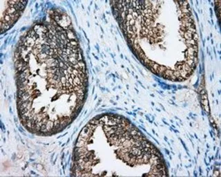 Anti-DNTTIP1 antibody [1E2] used in IHC (Paraffin sections) (IHC-P). GTX84603