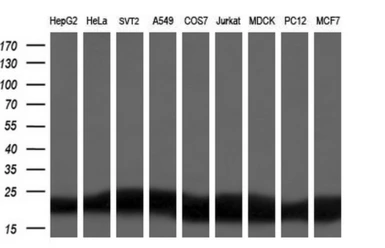 Anti-DHFR antibody [3A11] used in Western Blot (WB). GTX84618