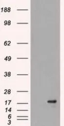 Anti-DHFR antibody [3A11] used in Western Blot (WB). GTX84618