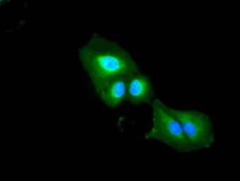Anti-ICAD antibody [5C4] used in Immunocytochemistry/ Immunofluorescence (ICC/IF). GTX84621