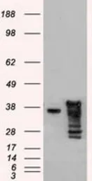 Anti-ICAD antibody [5C4] used in Western Blot (WB). GTX84621