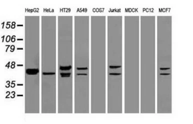 Anti-ICAD antibody [5C4] used in Western Blot (WB). GTX84621