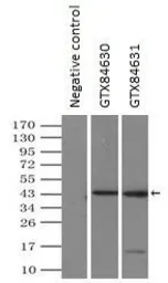 Anti-DAP Kinase 2 antibody [1C5] used in Immunoprecipitation (IP). GTX84631