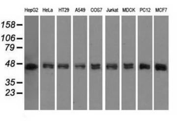 Anti-DAP Kinase 2 antibody [1C5] used in Western Blot (WB). GTX84631