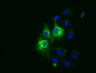 Anti-CYB5R3 antibody [1E3] used in Immunocytochemistry/ Immunofluorescence (ICC/IF). GTX84645