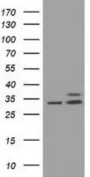 Anti-CYB5R3 antibody [1E3] used in Western Blot (WB). GTX84645