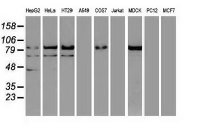 Anti-beta Catenin antibody [1F3] used in Western Blot (WB). GTX84650