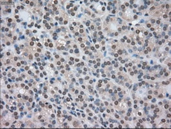 Anti-CTAG1B antibody [3C9] used in IHC (Paraffin sections) (IHC-P). GTX84652
