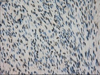 Anti-CTAG1B antibody [3C9] used in IHC (Paraffin sections) (IHC-P). GTX84652