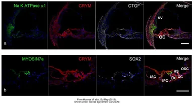 Anti-CRYM antibody [1G7] used in IHC (Frozen sections) (IHC-Fr). GTX84654