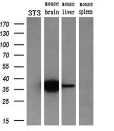 Anti-CRYM antibody [1G7] used in Western Blot (WB). GTX84654
