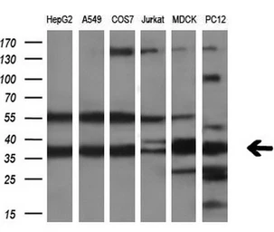 Anti-CRYM antibody [1B5] used in Western Blot (WB). GTX84655