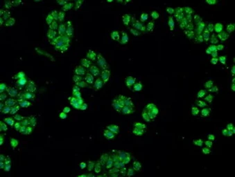 Anti-alpha B Crystallin antibody [6D11] used in Immunocytochemistry/ Immunofluorescence (ICC/IF). GTX84657