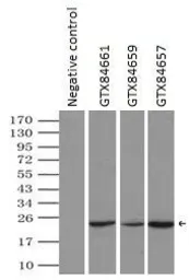 Anti-alpha B Crystallin antibody [6D11] used in Immunoprecipitation (IP). GTX84657