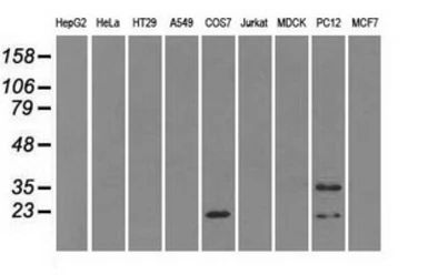 Anti-alpha B Crystallin antibody [6D11] used in Western Blot (WB). GTX84657
