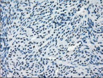 Anti-alpha B Crystallin antibody [6A9] used in IHC (Paraffin sections) (IHC-P). GTX84659