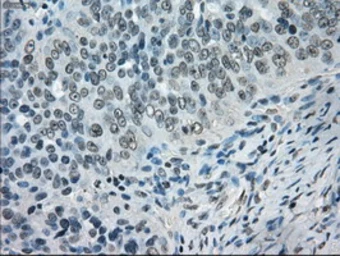 Anti-alpha B Crystallin antibody [3C2] used in IHC (Paraffin sections) (IHC-P). GTX84661