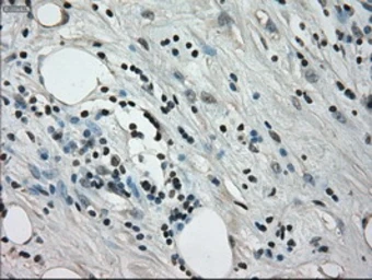 Anti-alpha B Crystallin antibody [3C2] used in IHC (Paraffin sections) (IHC-P). GTX84661