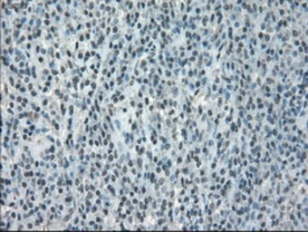 Anti-alpha B Crystallin antibody [3C2] used in IHC (Paraffin sections) (IHC-P). GTX84661