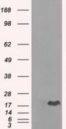 Anti-alpha B Crystallin antibody [3C2] used in Western Blot (WB). GTX84661