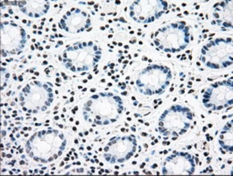 Anti-CNDP1 antibody [2F8] used in IHC (Paraffin sections) (IHC-P). GTX84677