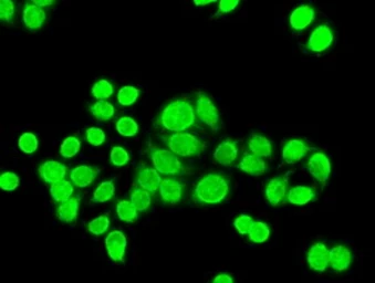 Anti-Chk2 antibody [2F4] used in Immunocytochemistry/ Immunofluorescence (ICC/IF). GTX84685