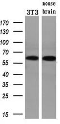 Anti-Chk2 antibody [2F4] used in Western Blot (WB). GTX84685