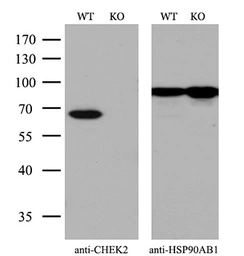 Anti-Chk2 antibody [2F4] used in Western Blot (WB). GTX84685