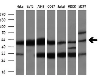 Anti-CUGBP1 antibody [5B8] used in Western Blot (WB). GTX84692