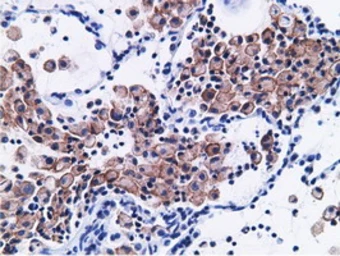 Anti-CD80 antibody [2B11] used in IHC (Paraffin sections) (IHC-P). GTX84701